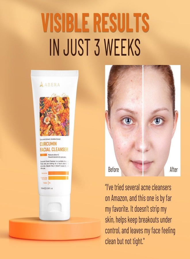 ABERA Turmeric Face Wash for Acne-Prone & Sensitive Skin – 4-in-1 Curcumin Cleanser with Niacinamide, BHA & Centella – Gentle pH Balanced, Non-Comedogenic, Sulfate Free Facial Cleanser, 3.38 Fl.oz. - Image 3